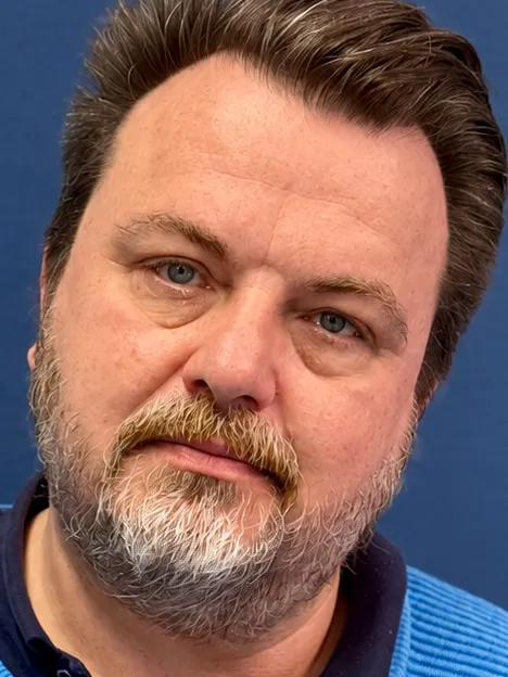 Thomas Skerbis